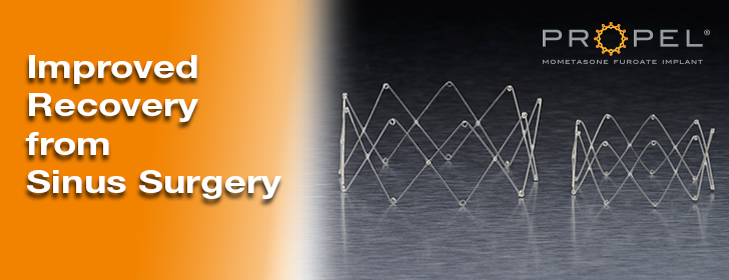 Sinus Surger